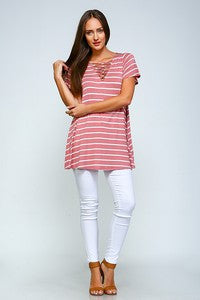 Criss-Cross Striped Tunic